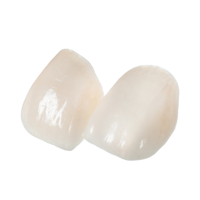 家红水晶瓷氧化锆贴面