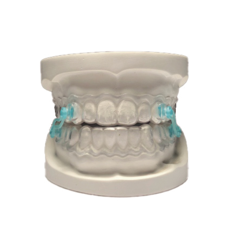 常规阻鼾器(塑料连杆)