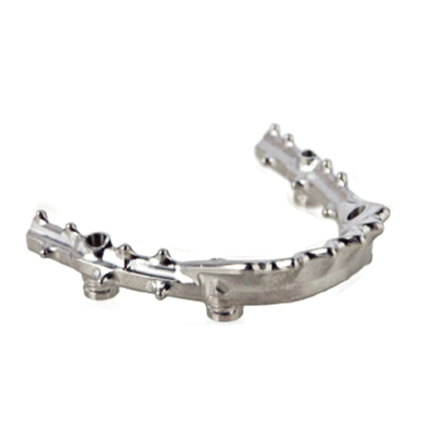 混合型杆卡覆盖义齿