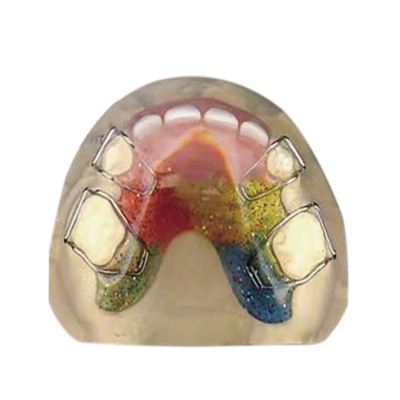 活动间隙保持器