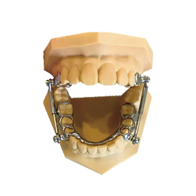 Herbst咬颌前移器